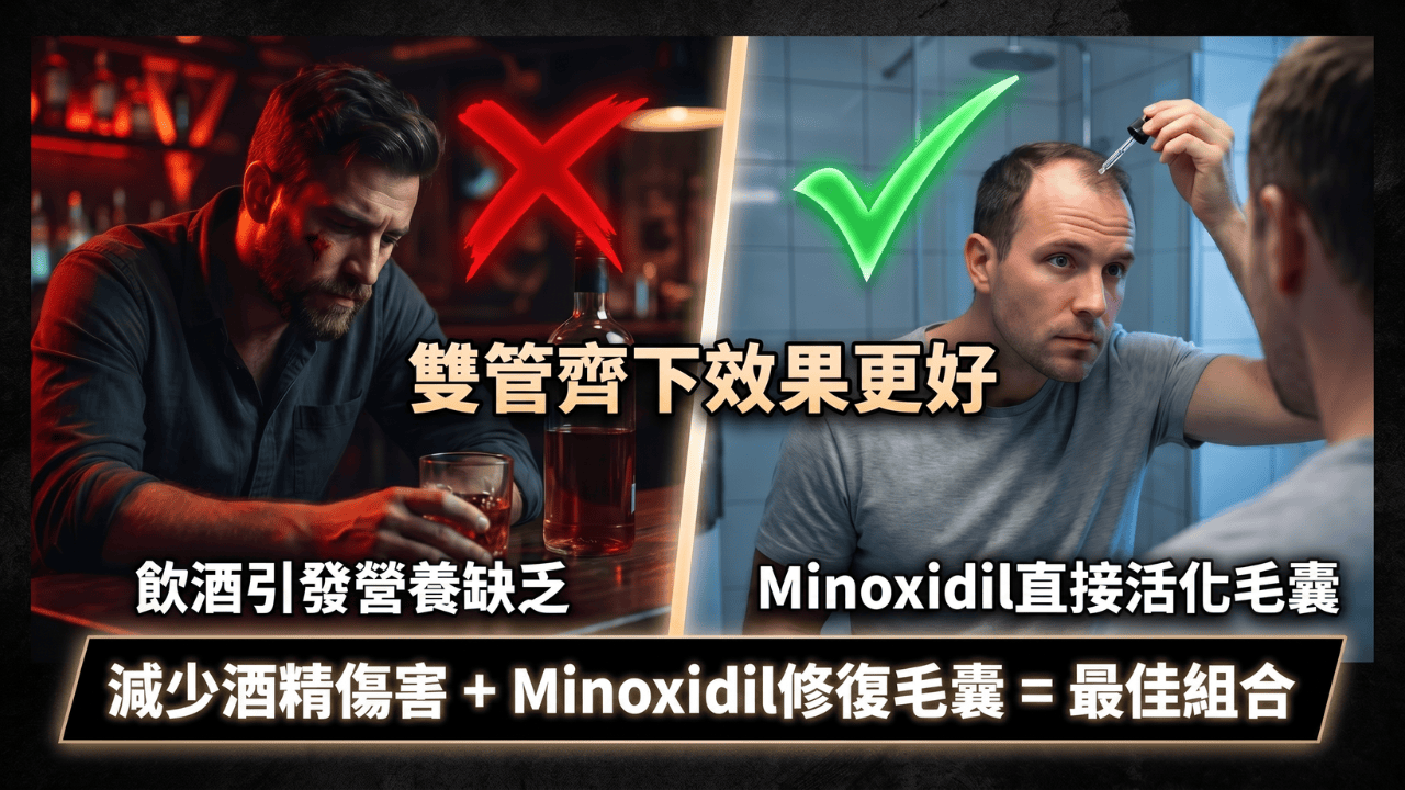 減少飲酒 + Minoxidil修復毛囊 = 最佳組合