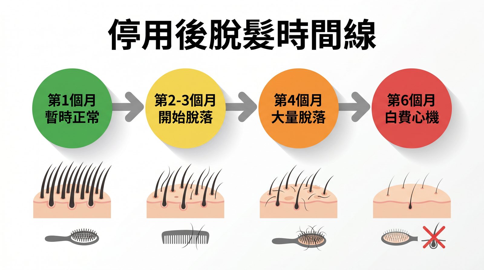 停用後脫髮時間線：4 個階段對照圖