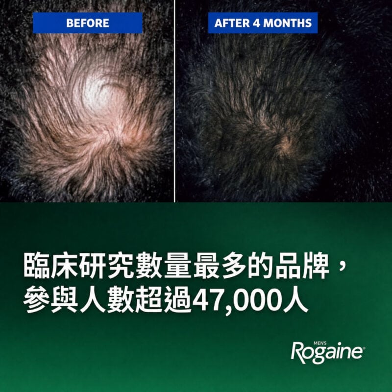 ROGAINE 5% Minoxidil 男士生髮劑 液體外用配方 香港現貨