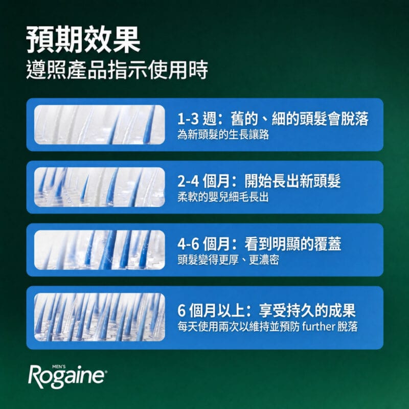ROGAINE 5% Minoxidil 男士生髮泡沫
